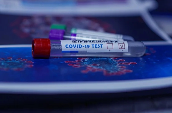 covid_test_pixabay_139340251